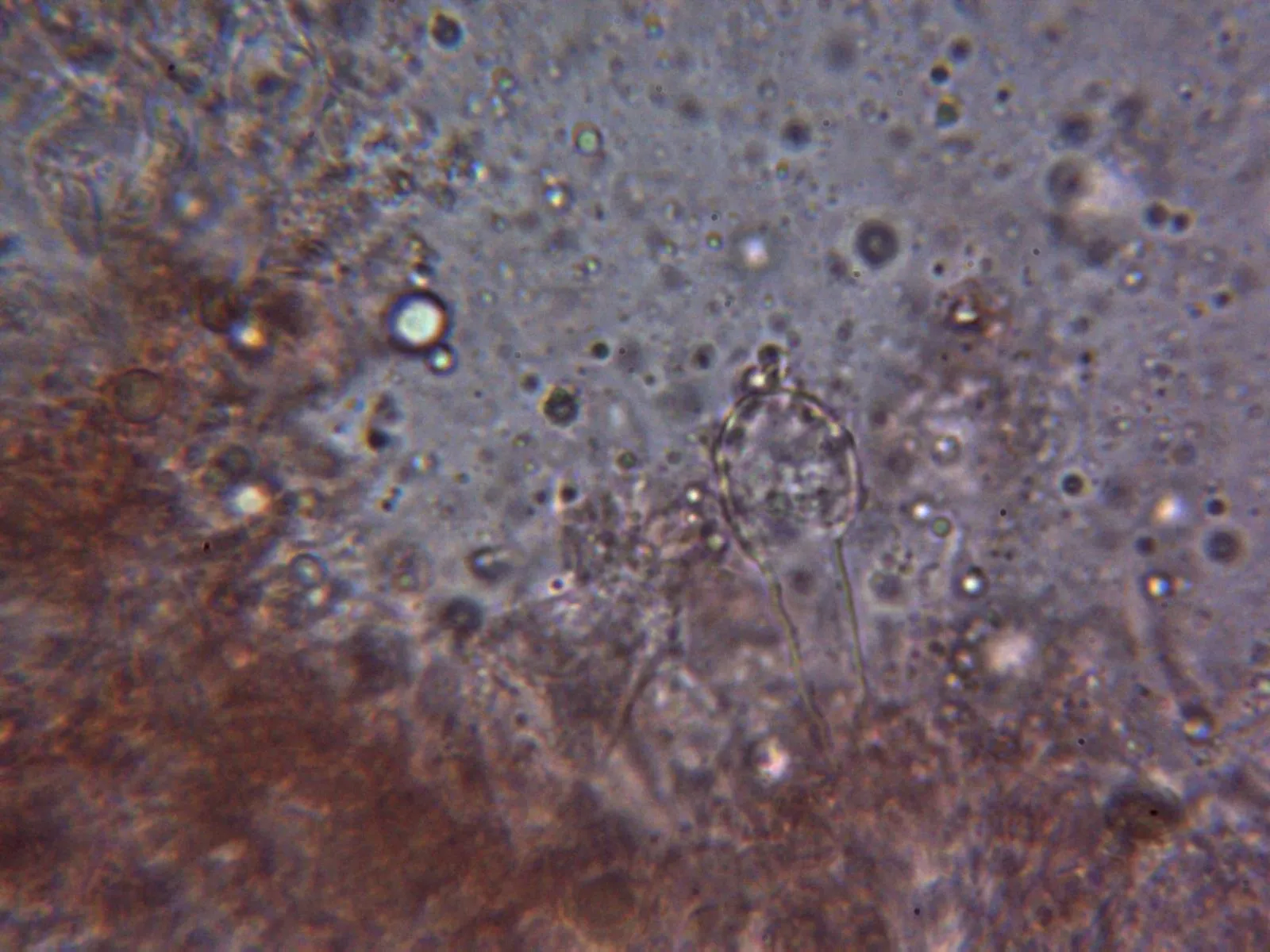 Microscopía de Mycena galericulata - 10 - Queilocistidio 1